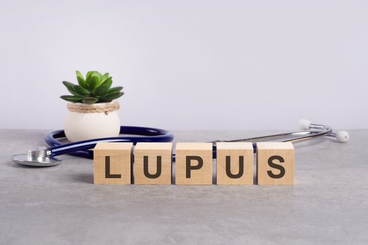 Lupus: los síntomas asociados a esta enfermedad