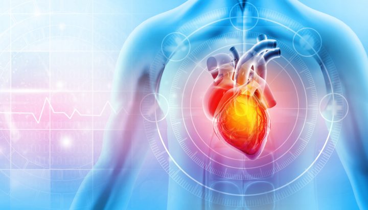 ¿Qué factores están influyendo en la ocurrencia de infartos?