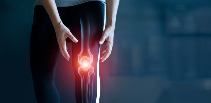 Prevén que mil millones de personas sufrirán artritis en 2050