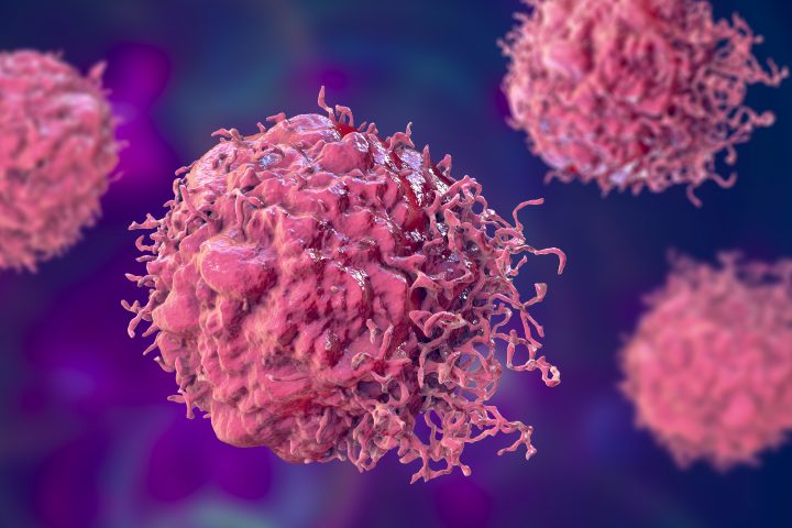 Ensayan en Chile con nanopartículas para tratar cáncer