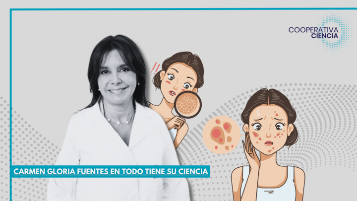 ¿Hay relación entre el estrés y las enfermedades dermatológicas?