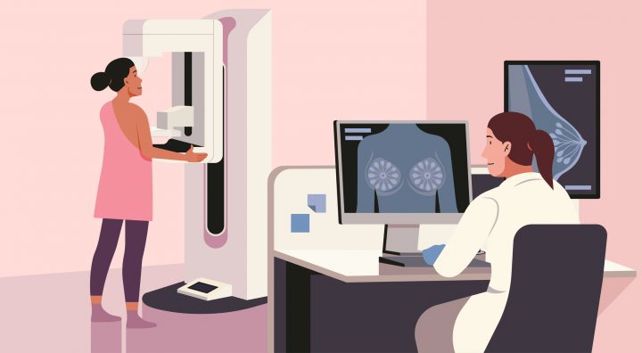 Salud Inteligente: IA al servicio del diagnóstico temprano del cáncer de mama