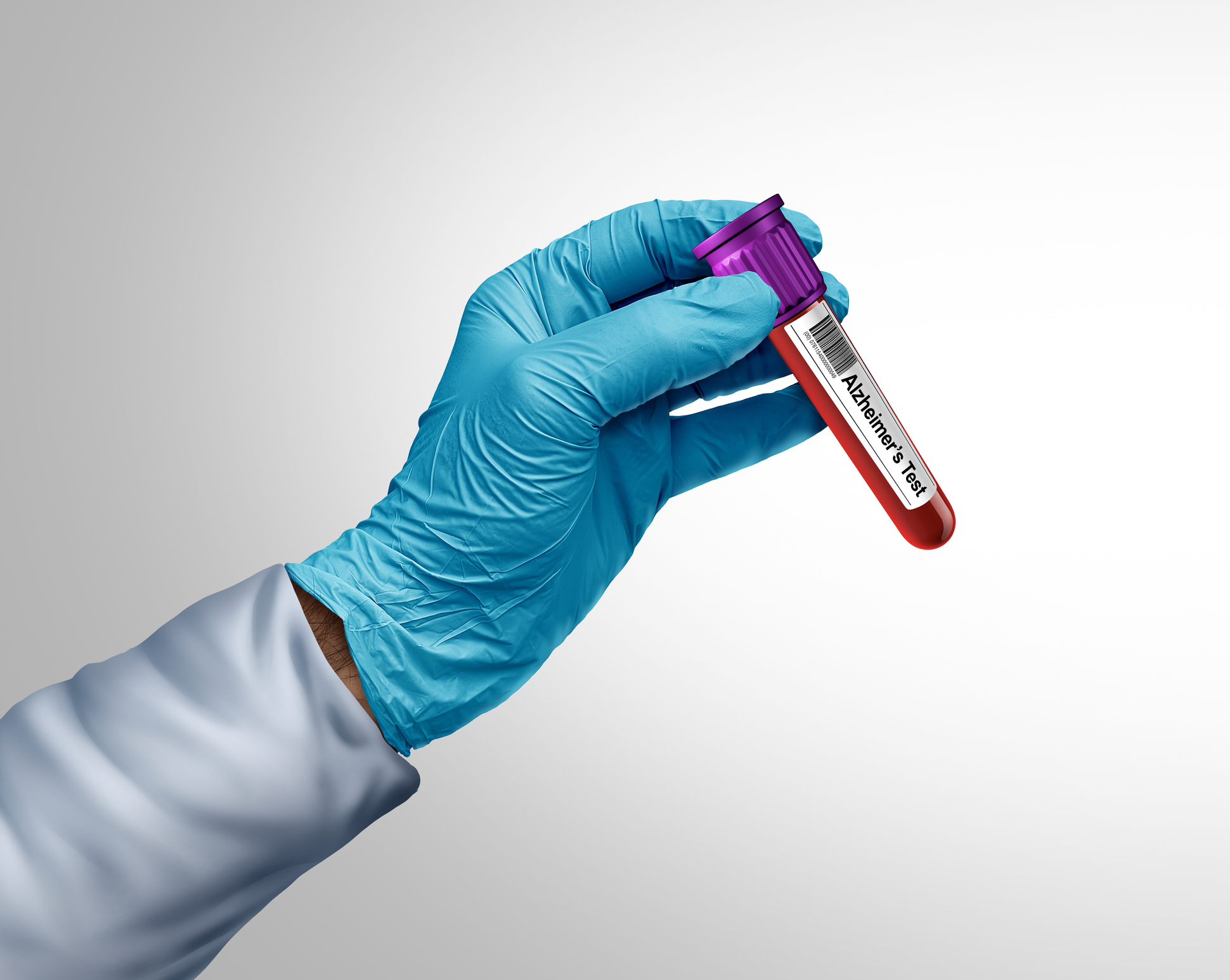 Estados Unidos aprueba el primer test sanguíneo para la detección temprana del Alzheimer
