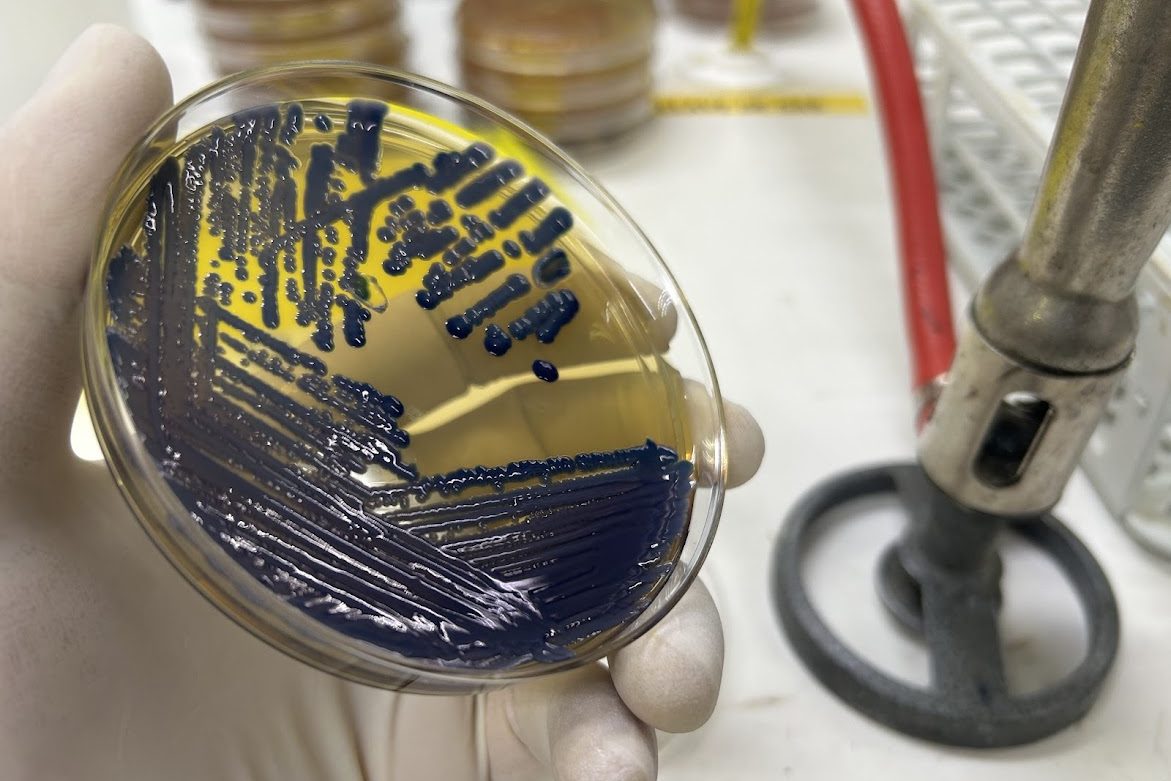 Detectan por primera vez en Chile brote de una «superbacteria» multirresistente en mascotas