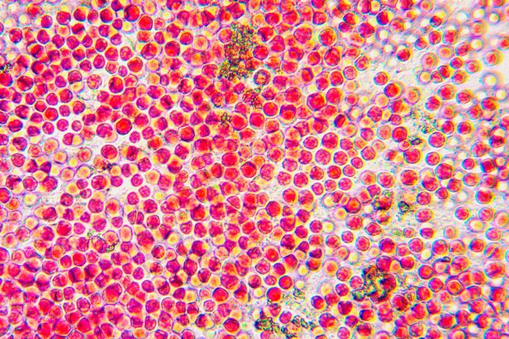 Microalga 