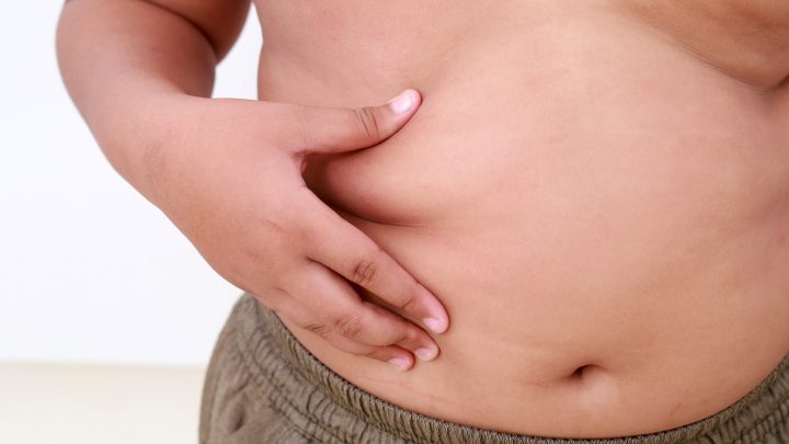 Obesidad infantil supera por primera vez al bajo peso como la forma más común de malnutrición