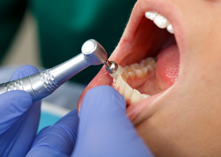 Más allá del dulce: Cómo la alimentación impacta en la salud dental