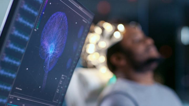 La IA mejora la interfaz cerebro-computador al interpretar la intención del usuario