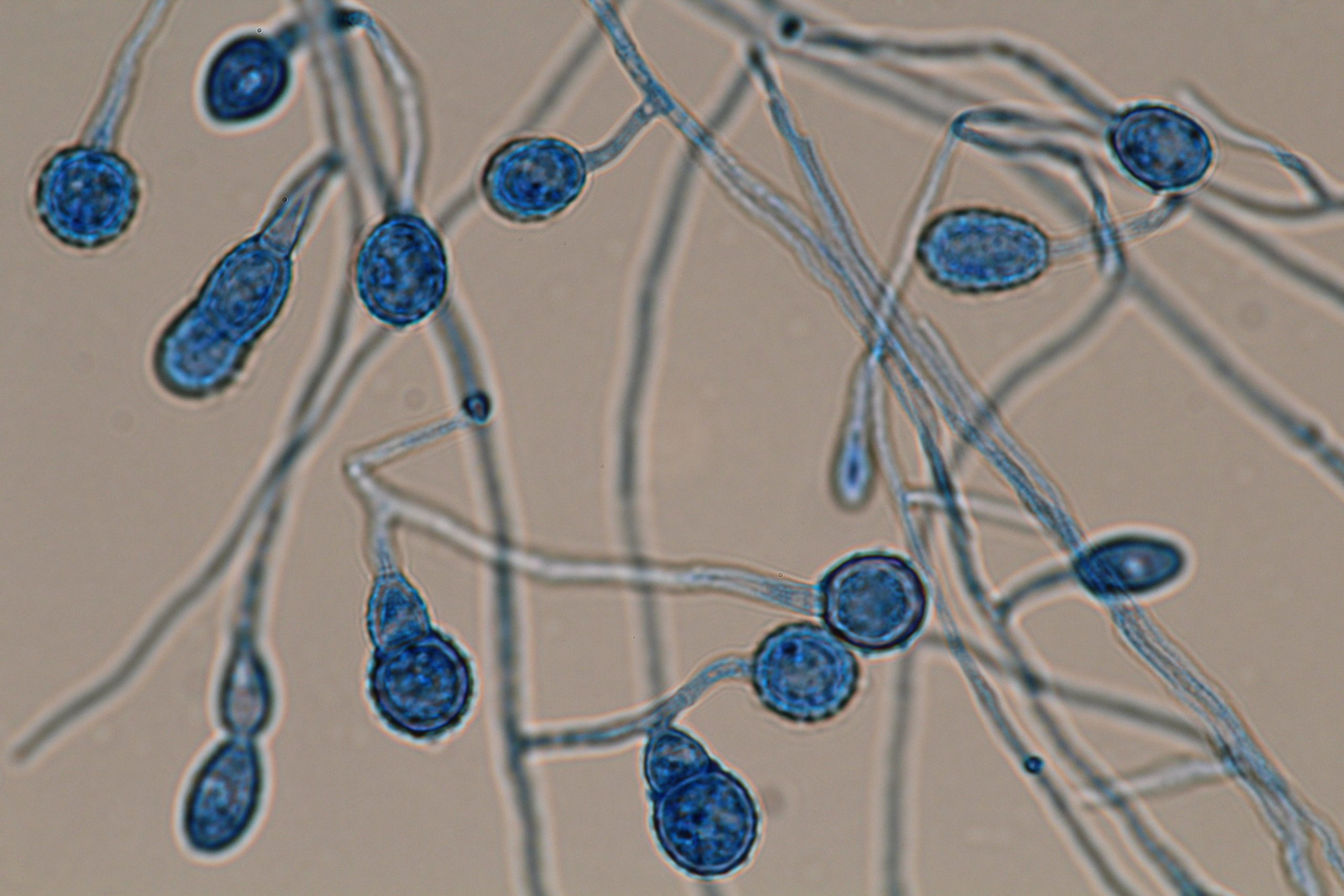 Descubren siete nuevas especies de hongos que podrían ser exclusivas de Chile