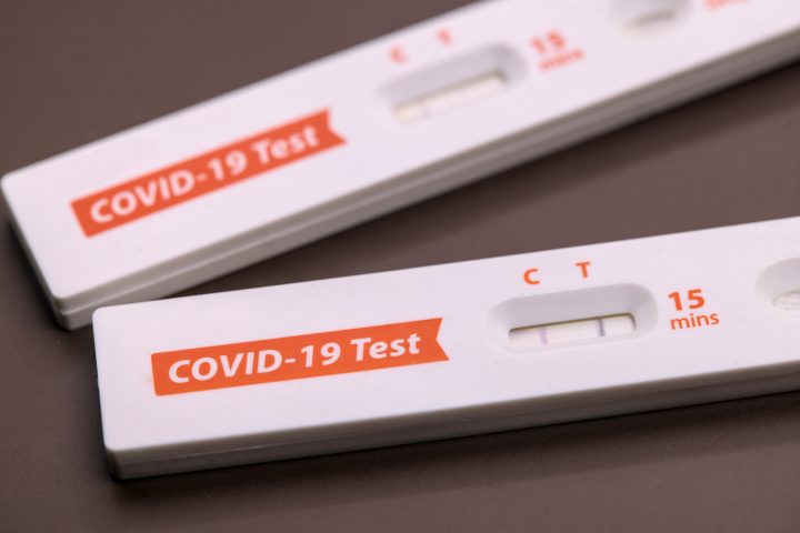 Estudio revela alta inmunidad frente al COVID-19 en Chile, pero advierte brechas en vacunación