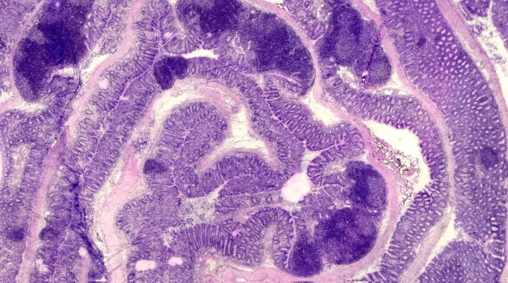 Imagen histológica de un colon inflamado de ratón. Foto: Laboratorio Villablanca.