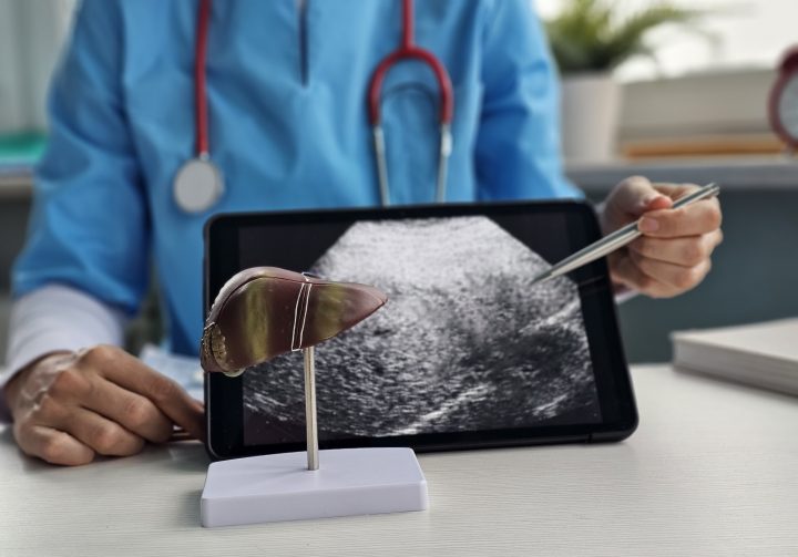Estudiante trabaja en tecnología no invasiva para diagnosticar hígado graso