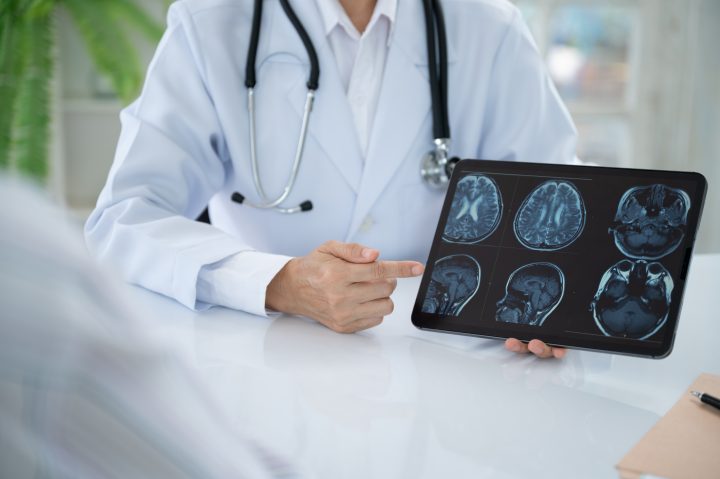 Estudio chileno revela cómo fallan los astrocitos ante enfermedades neurodegenerativas