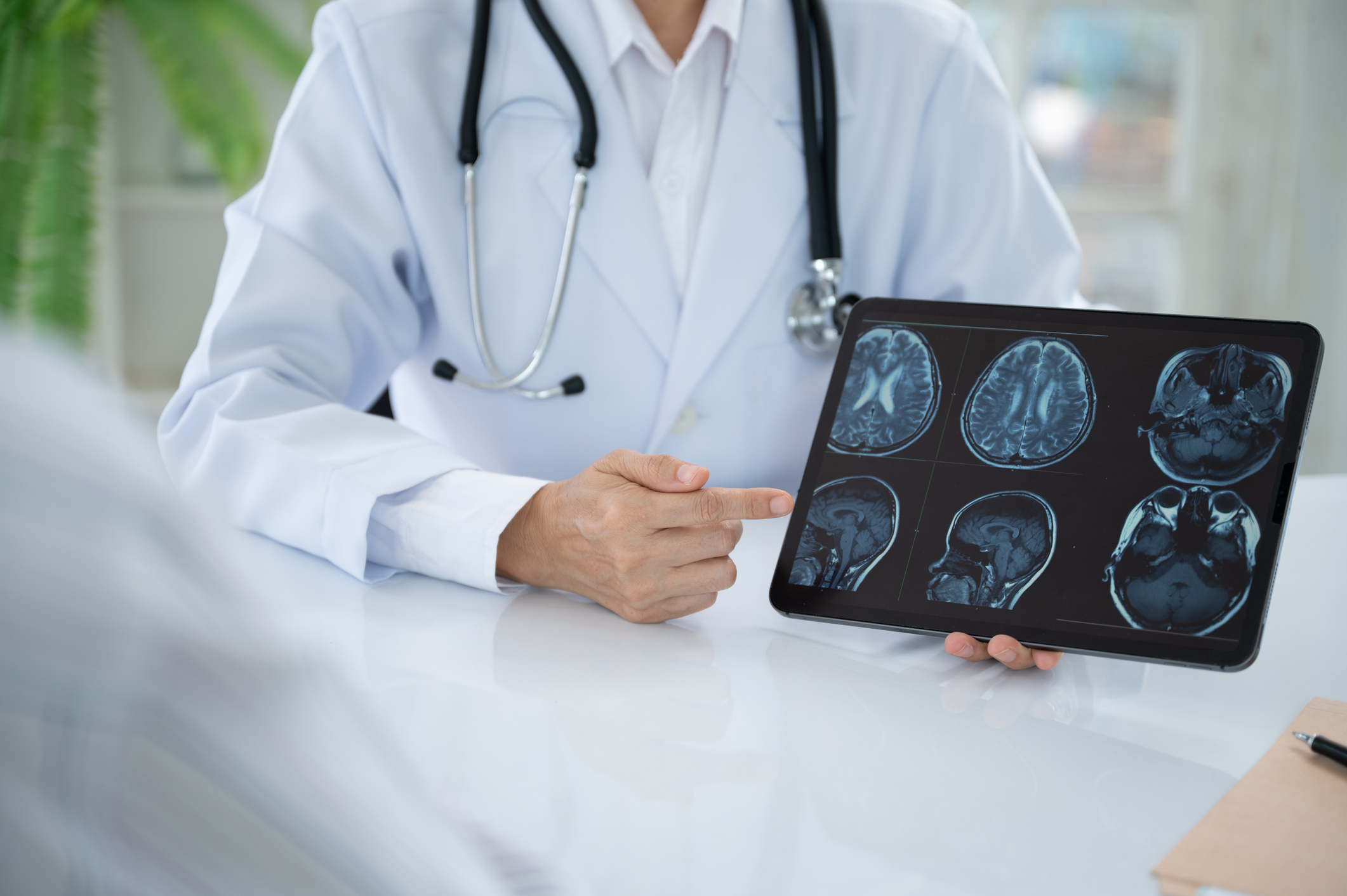 Estudio chileno revela cómo fallan los astrocitos ante enfermedades neurodegenerativas