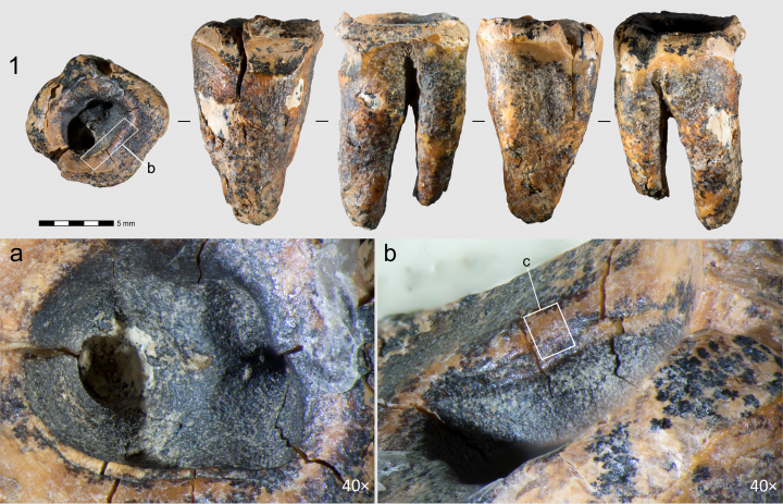Neandertales trataban caries con herramientas de piedra hace 60.000 años
