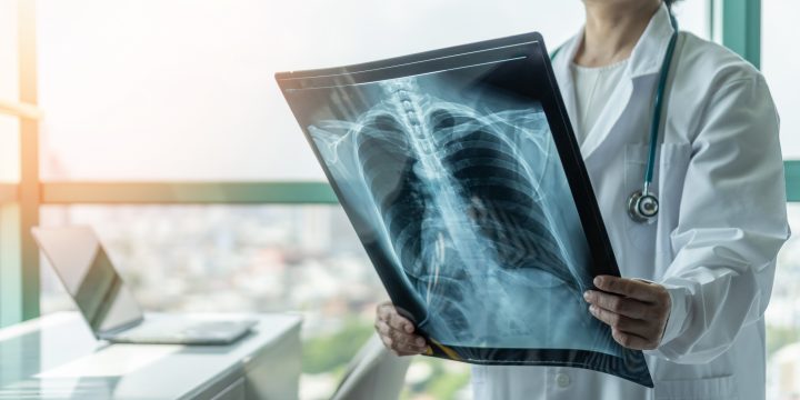 Modelo con IA creado en Chile busca reducir la mortalidad por neumonía en personas mayores