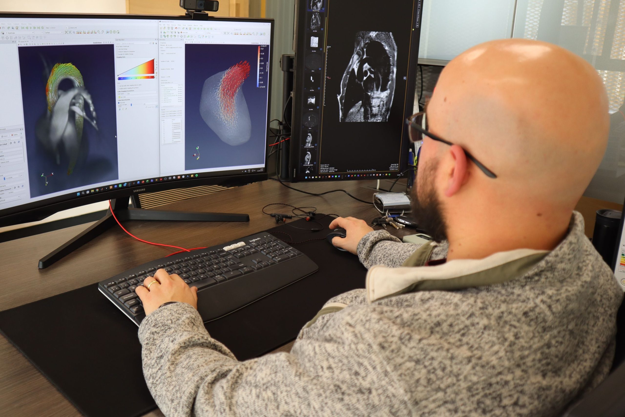 Desarrollan plataforma de análisis automatizado para el diagnóstico de enfermedades cardiovasculares